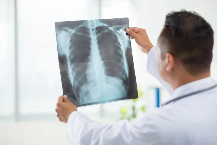 Diagnosing Disease in X-rays, Artificial Intelligence Fails to Compete with Doctors