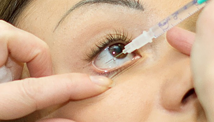 The use of injections that affect vision is prohibited