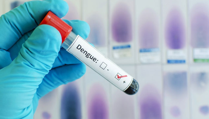 51 more people suffering from dengue —File photo
