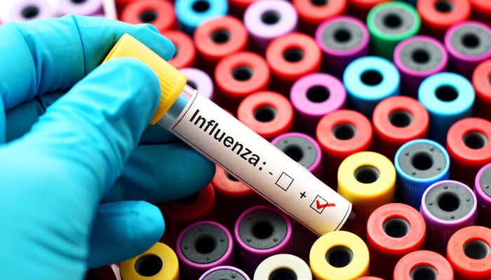 Advisory issued on rising flu virus in Karachi The health department has instructed to take precautionary measures.