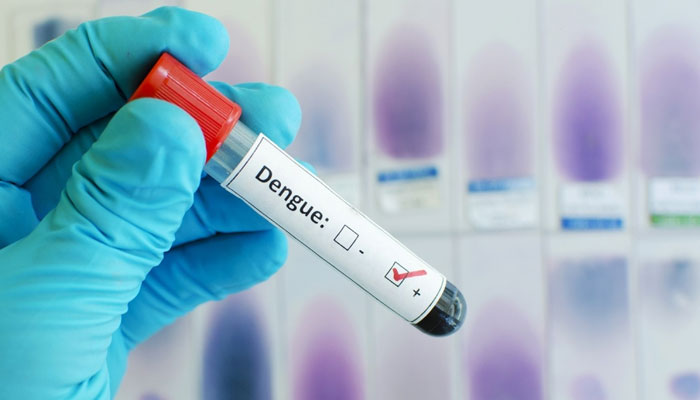 Dengue virus confirmed in 21 more people —File photo
