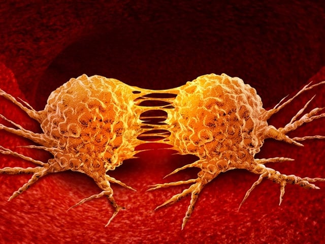 Major advances in cervical cancer therapy