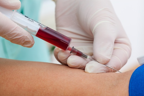 Taking too much blood for a test can cause dangerous blood loss