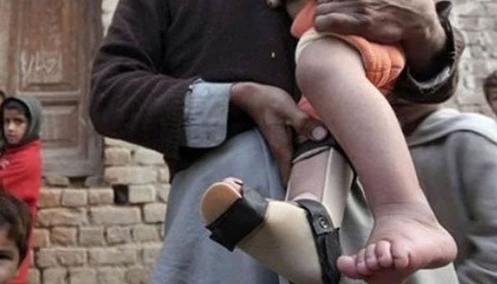 Third case of polio confirmed in the country