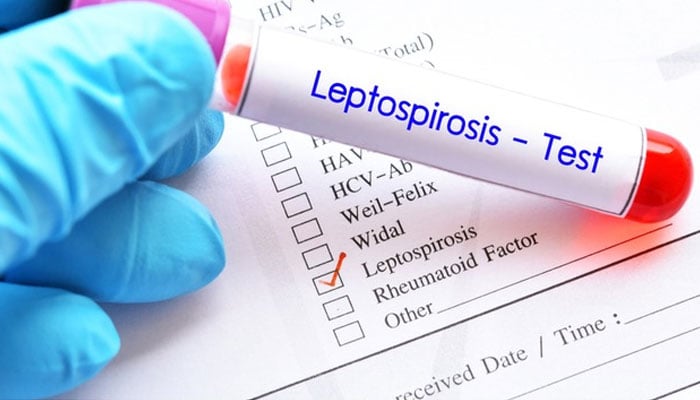 1 person died from a very rare infectious disease -----File photo