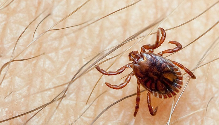 Another patient suffering from Congo virus transferred to Karachi File photo