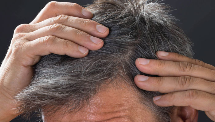 Why is human hair white? —File photo