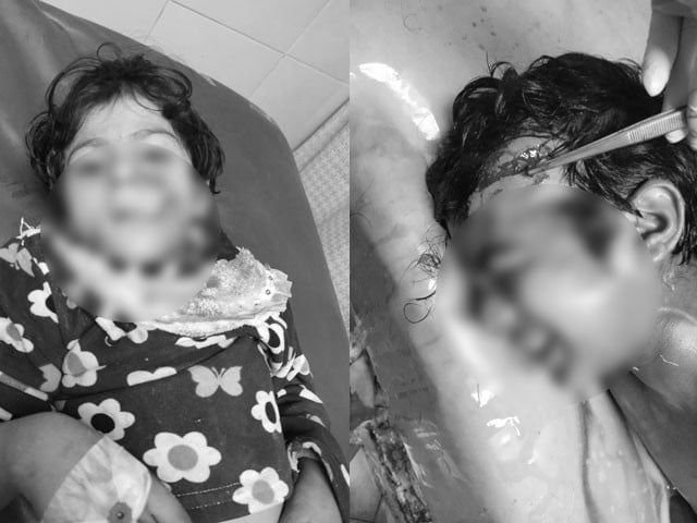 6 children were bitten by stray dogs in Lahore Photo Express