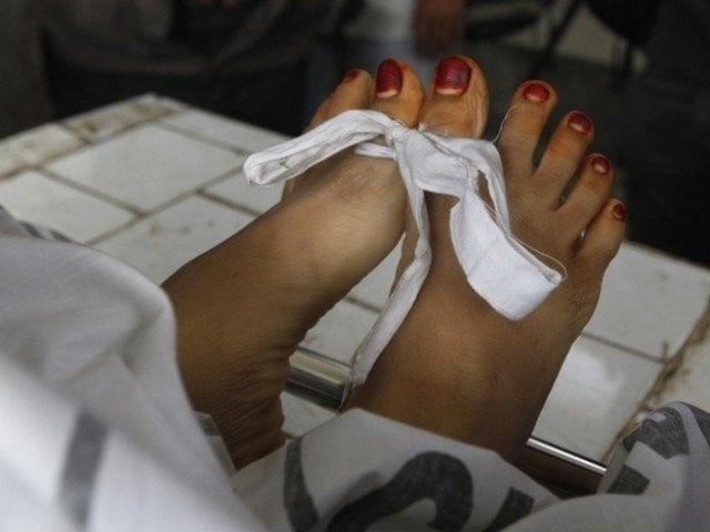 A woman fell down from her bike and died during the purse snatching incident In the incident, the husband and 2 children were also injured when the motorcycle fell. Photo: File