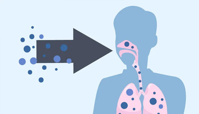 An outbreak of the fungal infection histoplasmosis was revealed in Islamabad