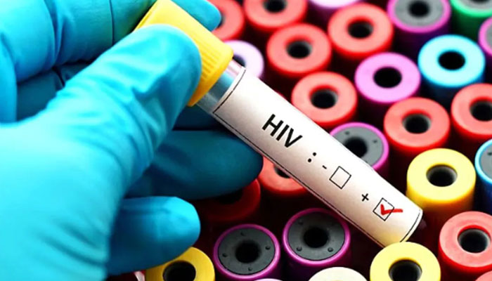 6966 HIV patients reported since 2005 ---File photo