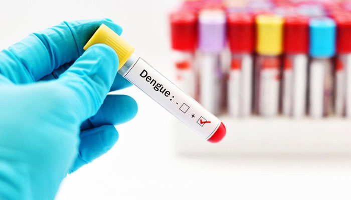 3 more people suffering from dengue File photo