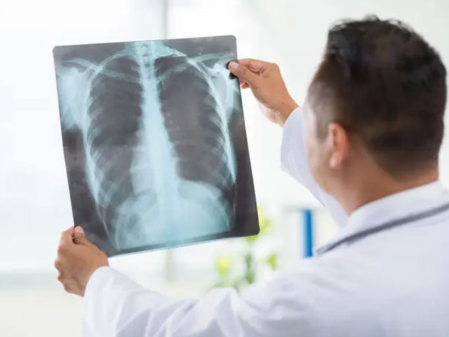 An artificial intelligence model that examines X-rays like doctors