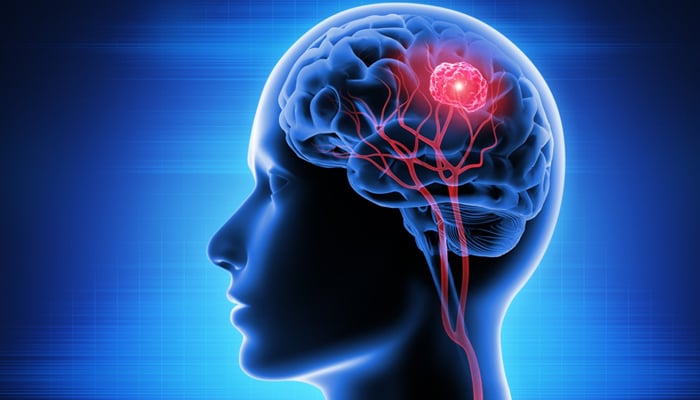 Brain tumor diagnosis method discovered with standard blood test