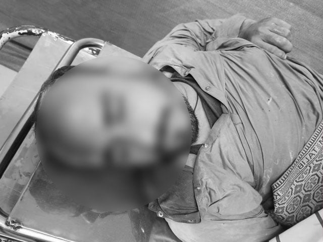 A citizen died while in custody in Karachi, police officials left the body near the house