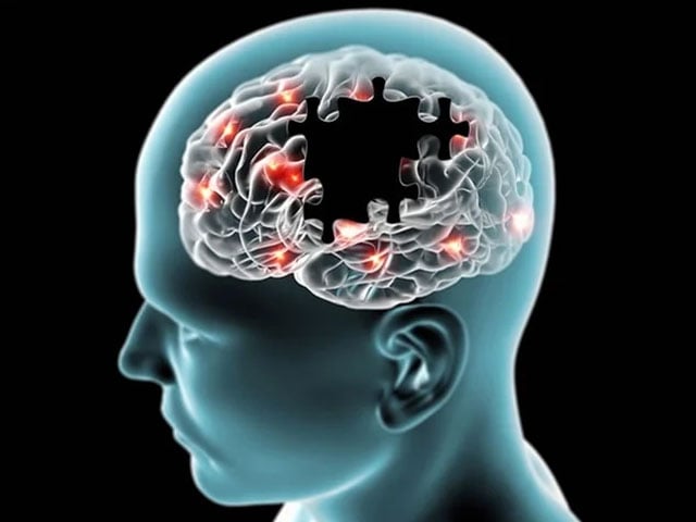 Simple and easy method for diagnosis of Alzheimer's disease