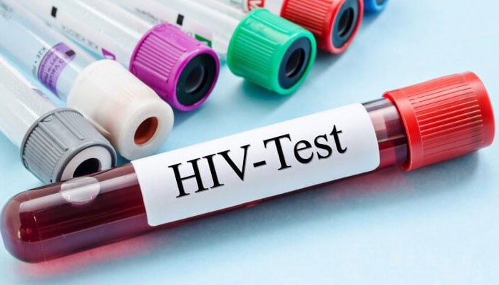 Encouraging results from British HIV vaccine trial --- File photo