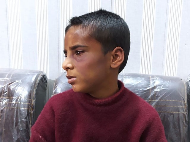 Husband and wife arrested for torturing a 10-year-old domestic worker in Lahore Husband and wife arrested for torturing a 10-year-old domestic worker in Lahore