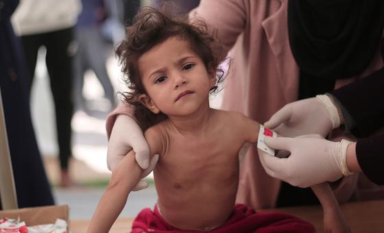 Gazans ‘hanging by a thread’, warns WFP