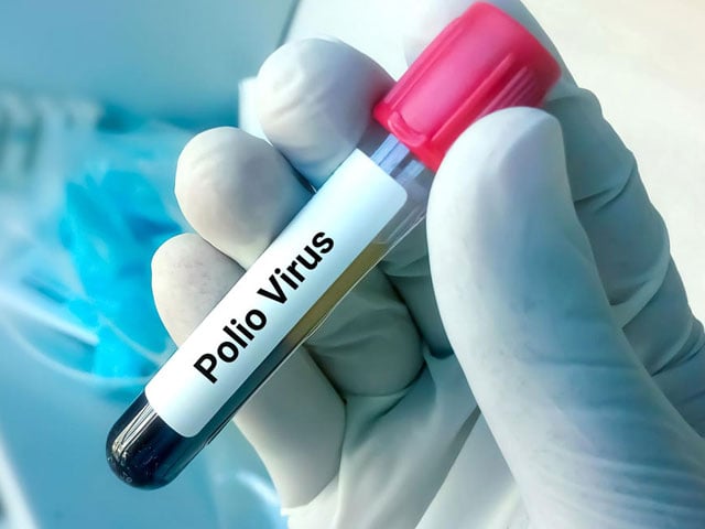 Confirmation of presence of polio virus in environmental samples of Badin district