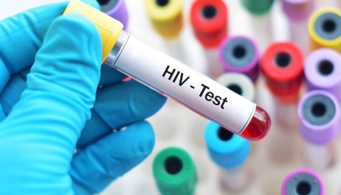 Rapid increase in HIV cases in Pakistan since 2017