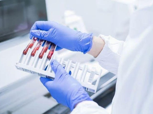 Blood tests for pancreatic cancer diagnosis are in progress