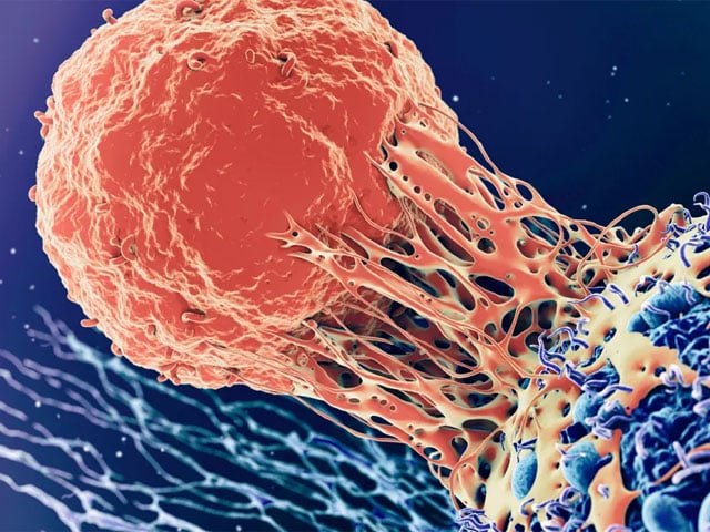 Prostate cancer incidence is expected to double by 2040