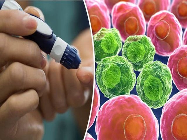 Type 2 diabetes has genetic link with different types of cancer, study