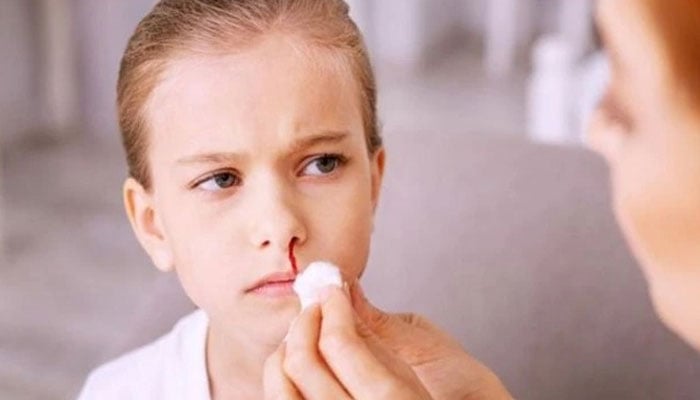 What to do if bleeding occurs? --- File photo