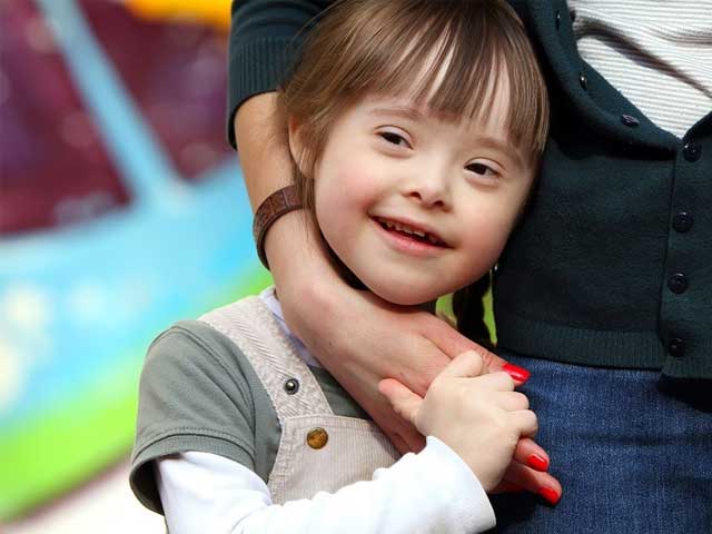 Symptoms of Down Syndrome - Express Urdu