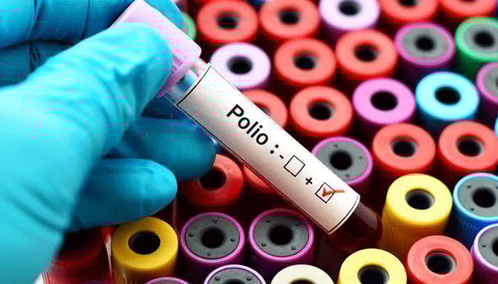 Polio virus spread in 42 districts of Pakistan File photo