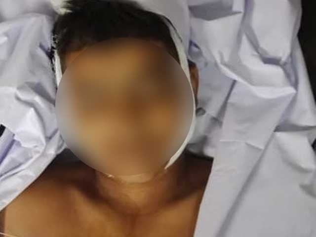 The body of the deceased Samad is lying in the hospital (Photo Express Web).